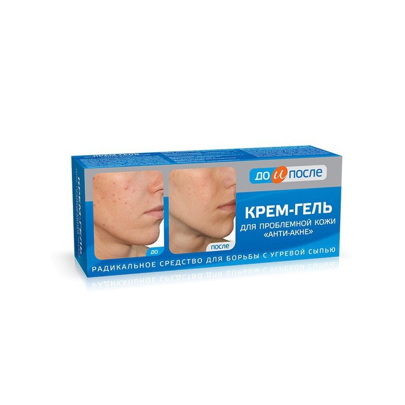 

До и после крем-гель д/лица Анти-акне д/проблемн.кожи 50мл 8106